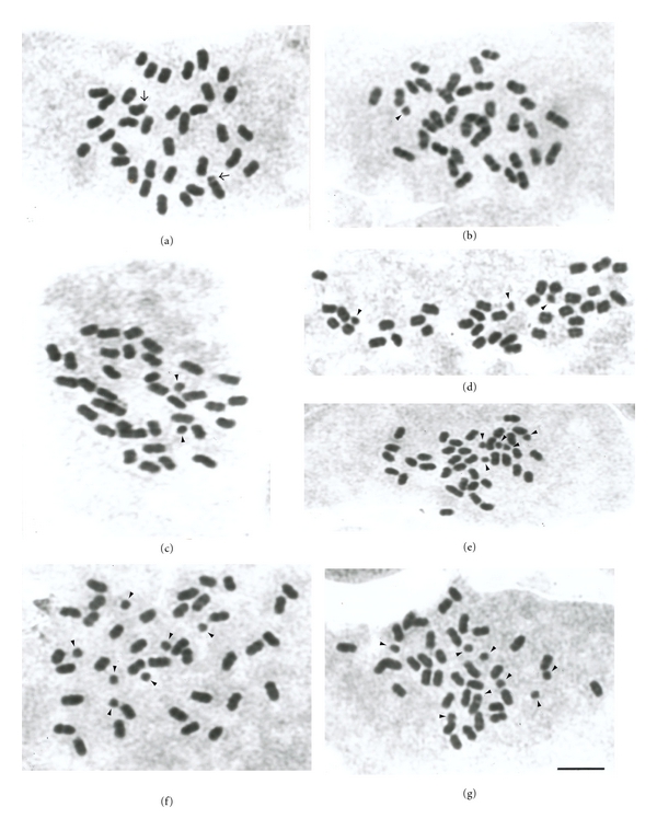 supernumerary chromosomes